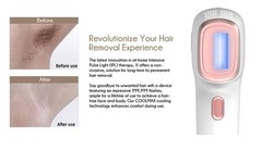 Touch-screen Handheld Chrome Alloy 3in1 IPL Laser Hair Removal Device 9 Levels