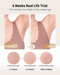 Laser Hair Removal with Ice Cooling Care Function for Women Men Permanent
