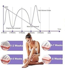 Permanent Painless Hair Removal System, IPL Hair Removal Device