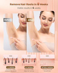 Laser Hair Removal, IPL Hair Removal Device System with 9 Intensity Levels for L