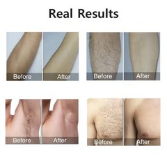 Laser Epilator Pulsed Light Hair Remover Permanent Hair Removal Painless Flash