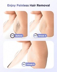 Painless IPL Laser Hair Removal Device with Cooling System for Men and Women