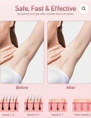 AMZGIRL IPL Hair Removal Device For Women & Men Whole Body Use At Home