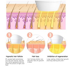 2026 Pink Hair Removal Device Personal Care Device Hair Removal Device Home Use