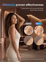 IPL Hair Removal Device with Cooling System Permanent Hair Remover Unisex