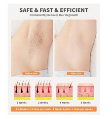 Hair Removal Device, Laser Hair Removal for Women Permanent with 9 Energy Levels