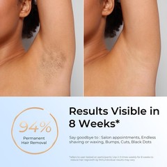 Finequin Laser Hair Removal, IPL Removal for Women and Champagne