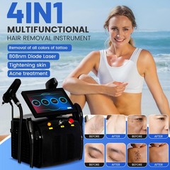 4-In1 IPL Diode Laser Hair Removal Pico Nd Yag Picosecond Tattoo Removal Machine