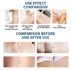 Painless DPL Hair Removal Laser Machine Skin Rejuvenation Whitening Spots Remove