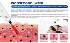 2-In-1 808 Diode Laser Hair Removal +Picosecond Tattoo Removal Skin Rejuvenation