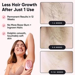 RoseSkinCo Lumi IPL Laser Hair Removal Device, At Home Permanent Hair Reducti…