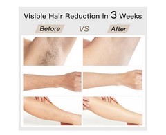 BoSidin Pioneer-Pro Permanent Hair Removal Device