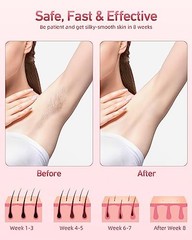AMZGIRL Laser Hair Removal for Women Men, At-Home