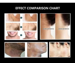 Professional 2 In 1 Diode Laser Hair Removal Machine Picosecond Tattoo Removal