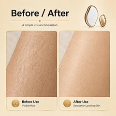 Crystal Hair Eraser for Women and Men, Gentle Exfoliating Hair Removal Tool, Reu