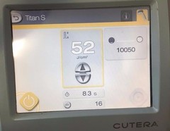 CUTERA TITAN S HAND PIECE, FULLY REFURBISHED AND CHARGED W/ PULSES, P4L1676