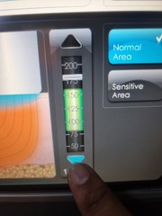 Used Syneron Candela eTwo Fractional RF Laser – Acne Scars, Wrinkles 💯 Working