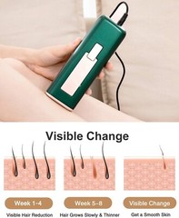 Sapyro IPL Hair Removal Device with Ice-Cooling Technology For woman and man
