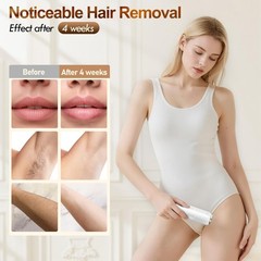 Laser Hair Removal, IPL Removal for Women and Men with 5 °C White
