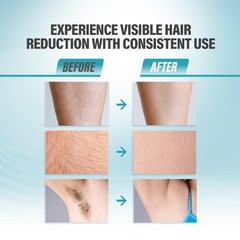 Herbishh IPL Laser Hair Removal Device – Black