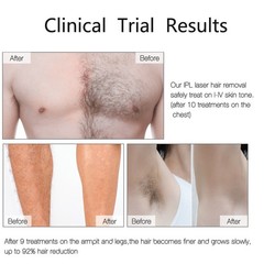 IPL Hair Removal Laser Permanent Body epilator Painless Device 999,999 Flashes