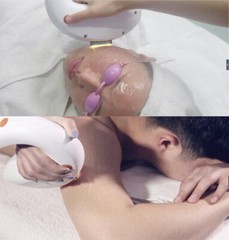 IPL OPT DPL Hair Removal Machine Laser Skin Rejuvenation Acne Vascular Removal