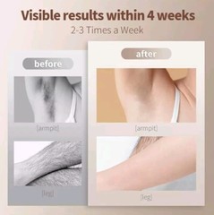 IPL Hair Removal Device 5 Energy Levels, Men Women Facial Legs Arms Bikini Line
