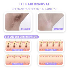 Professional IPL Laser Epilator 999,900 Flash Permanent Body Hair Removal