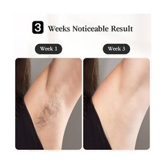 JOVS Laser Hair Removal, [24J Energy] IPL Hair Removal for Women and Men, 37