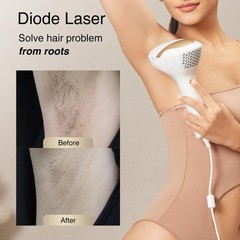 DermRays Laser Hair Removal for Women and Men, V4S Skin Tone 21J, White
