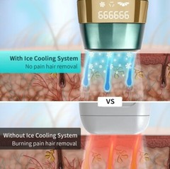 Laser Hair Removal For Women And Men, New Upgraded IPL Hair Removal. 72