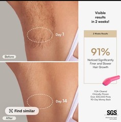 INIA HAUTE Pro Sapphire Ice Cooling IPL Hair Removal Device Pink FDA Cleared