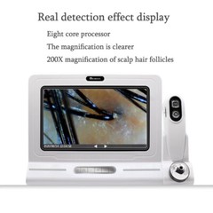 Hair Follicle Scalp Test Scanner Detector Hair/Skin/Scalp Hair Analysis Machine