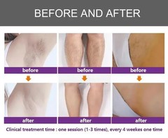 4 in 1 IPL Elight Diode Laser Hair Removal
