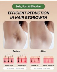 XSOUL At-Home IPL Hair Removal for Women and Men Hair Removal Tool Kit C1