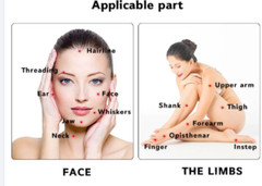 808 Diode Laser Hair Removal Yag 755 808 1064 Diode Laser Hair Removal Machine