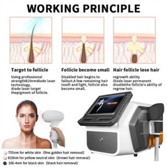810nm Diode Laser Hair Removal Machine 755 810 1064nm Ice Titanium Hair Removal