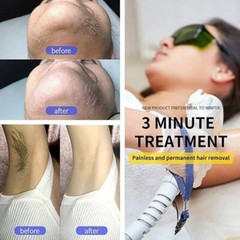 808nm Diode Laser Hair Removal Machine Painless Remove Hair Skin Whitening