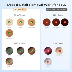 Finequin Laser Hair Removal, IPL Removal for Women and Champagne