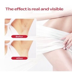 Rirsoasy Facial Hair Removal for Rose Gold, Gold White Pink Matte Black