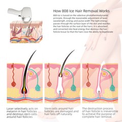 2-in-1 808nm diode laser hair removal nd yag Pico laser tattoo removal Machine
