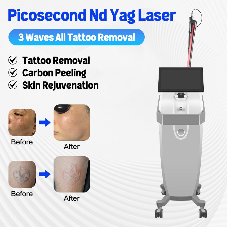 Fractional Laser Co2 Nd Yag Laser Tattoo Remove Facial Skin Rejuvenation Machine