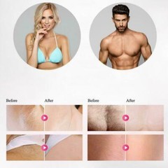 Professional Permanent LCD Display Lazer IPL Hair Removal Machine Photoepilator
