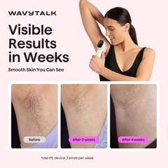 IPL Hair Removal Device, Bare It for Face Body Bikini – Long-Lasting Result & Pa