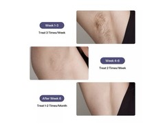 Ulike Air 3 UI20DB IPL Hair Removal Device in Purple Long-Lasting Results (EUC)