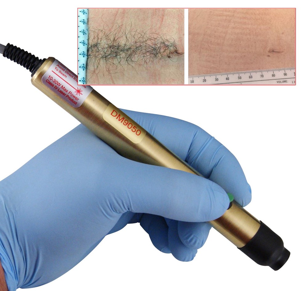 Permanent Hair Removal Laser Shaving Machine for Face Leg Skin Painless Epilator