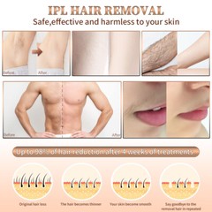 999999 IPL Laser Hair Removal Epilator Permanent Body Machine Face Leg w/Glasses