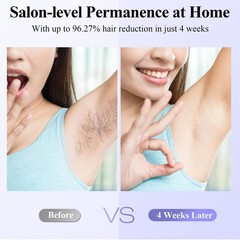 Xsoul Laser Hair Removal Sapphire 5℃ Ice Cooling, Painless & Permanent IPL