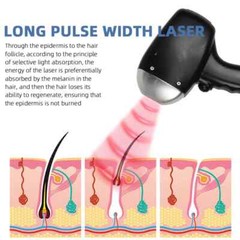 Ice Titanium 755 808 1064nm Diode Laer Hair Removal Machine Home Salon Use