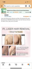 MiSMON IPL Hair Removal Device 300000 Flashes LCD Display for Arms Face